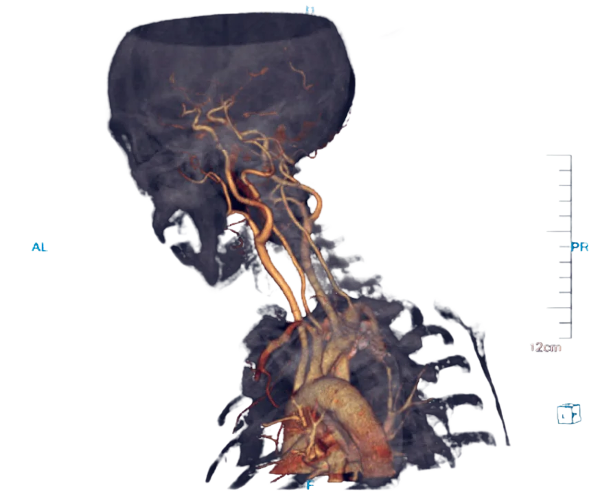 CT Scanner