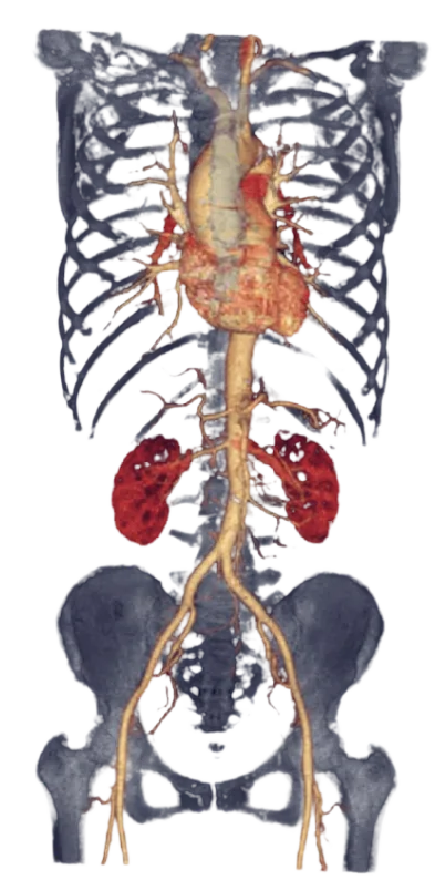 CT Scanner