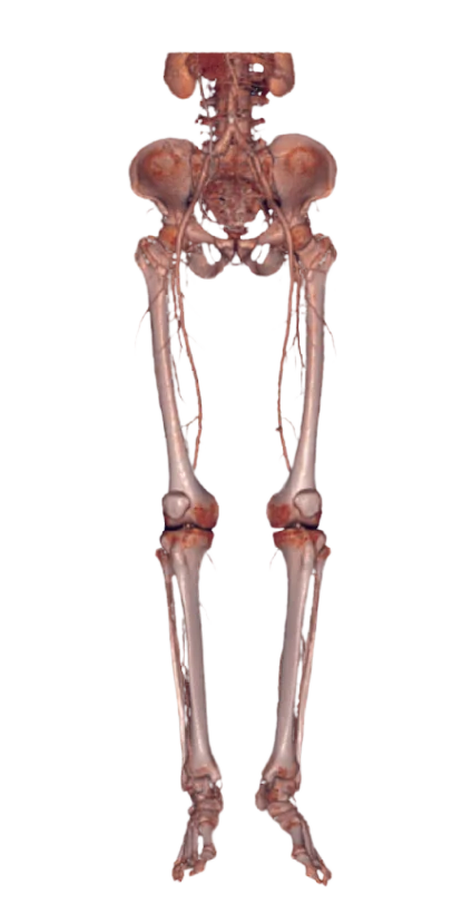 CT Scanner